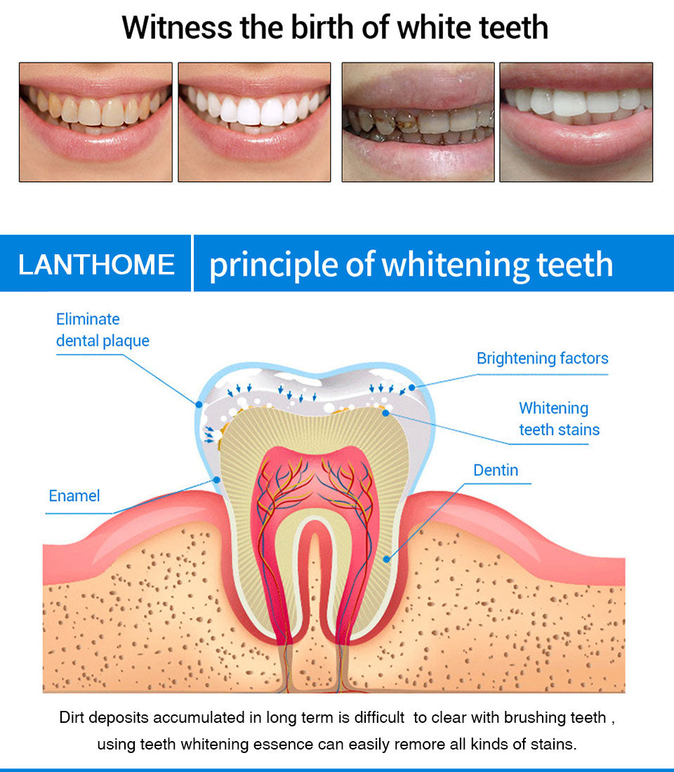 Trendvine™ Teeth Whitening Essence
